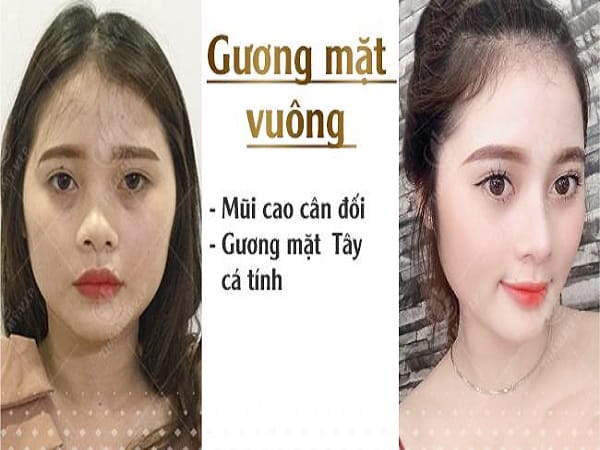 Bí quyết chọn dáng mũi cho mặt vuông góc cạnh hoàn hảo